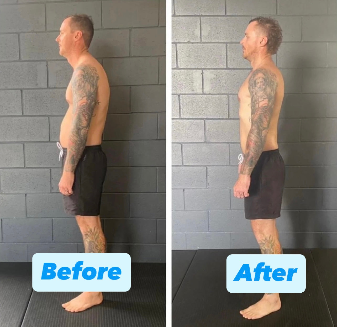 Posture Corrector - Improve Your Spine Alignment