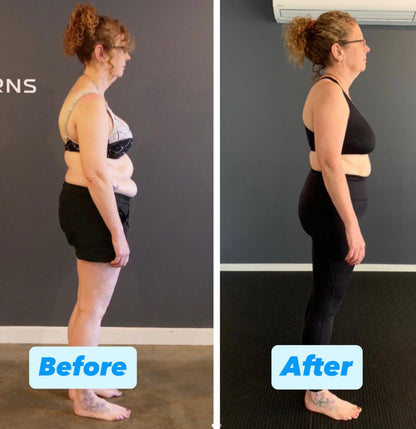 Posture Corrector - Improve Your Spine Alignment
